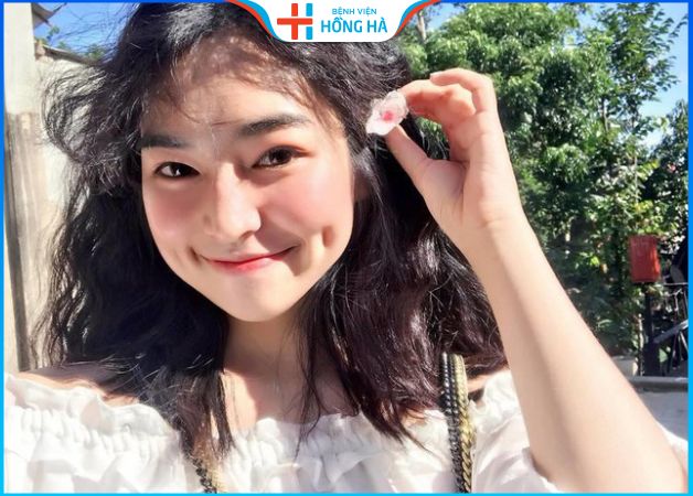 Sở hữu má lúm đồng tiền 1 bên chỉ sau 20 phút tại Hồng Hà