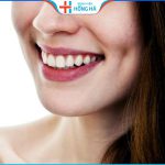 Má lúm đồng tiền bên phải duyên dáng – Bí ẩn tướng số