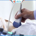 Siêu âm phát hiện 90% u xơ tử cung – Phương pháp siêu âm u xơ tử cung