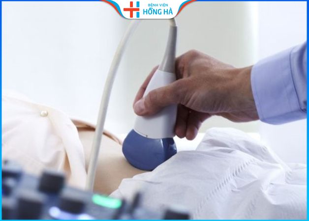 Siêu âm phát hiện 90% u xơ tử cung – Phương pháp siêu âm u xơ tử cung