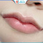 Tạo hình môi trái tim có được vĩnh viễn không? Địa chỉ tạo môi tim đẹp