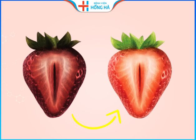 Thẩm mỹ vùng kín sau sinh – Bí quyết thăng hoa hạnh phúc