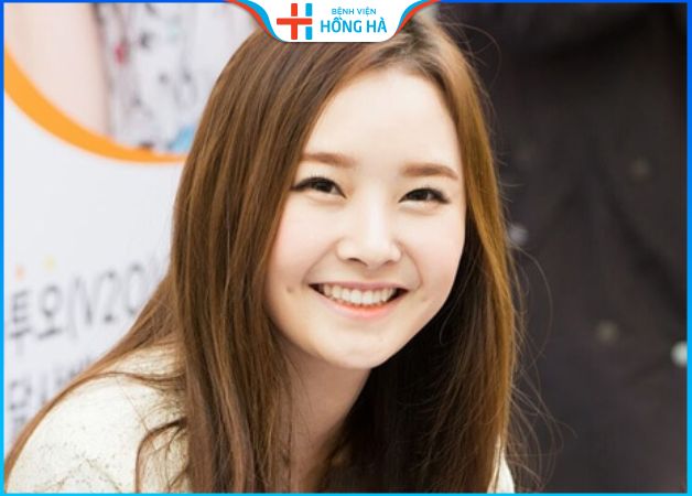 Vận mệnh của người có má lúm đồng tiền – Cách tạo má lúm duyên dáng