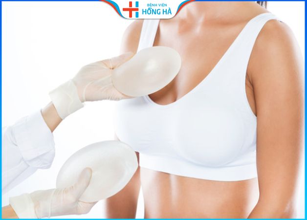 Nâng ngực giữ được bao lâu? 4 Yếu tố ảnh hưởng đến thời gian duy trì