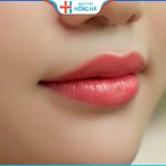 Thu mỏng môi bao lâu thì lành? Cách chăm sóc mau lành
