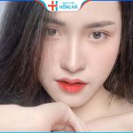 Thu nhỏ đầu mũi bao lâu hết sưng- 3 mẹo giảm sưng đau hiệu quả