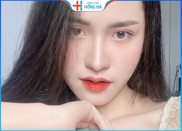 Thu nhỏ đầu mũi bao lâu hết sưng- 3 mẹo giảm sưng đau hiệu quả