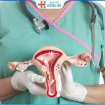 Top 2 bác sĩ giỏi trong điều trị đa nang buồng trứng với tỷ lệ hiệu quả cao