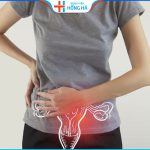 Bệnh u xơ tử cung: Những điều cần biết về phòng ngừa và điều trị hiệu quả