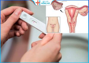 Cắt 1 bên buồng trứng có con được không – Cách thụ thai thành công