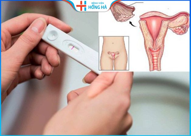 Cắt 1 bên buồng trứng có con được không – Cách thụ thai thành công