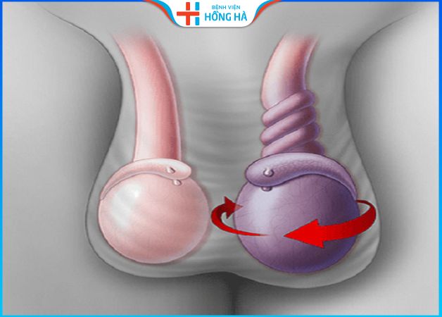 Cắt tinh hoàn: Những điều cần biết trước và sau phẫu thuật