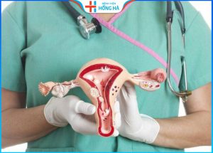 Tác động của đa nang buồng trứng một bên đến khả năng thụ thai