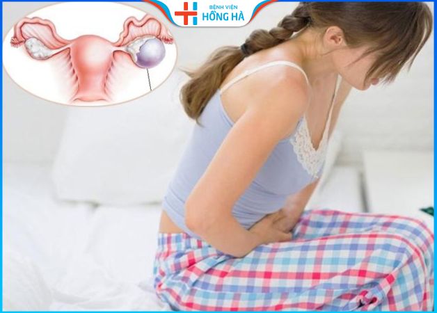 80% phụ nữ gặp dấu hiệu của đa nang buồng trứng: Tìm hiểu chi tiết