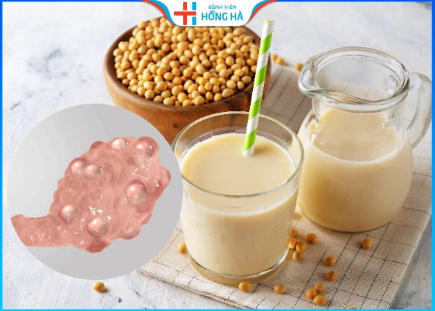 Tác dụng của sữa đậu nành đối với phụ nữ bị đa nang buồng trứng