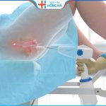 Các phương pháp điều trị viêm lộ tuyến hiệu quả nhất theo 3 cấp độ