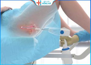 Các phương pháp điều trị viêm lộ tuyến hiệu quả nhất theo 3 cấp độ