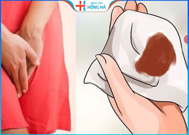 Khí hư màu nâu: Nguyên nhân gây ra 9 bệnh lý nguy hiểm sức khỏe