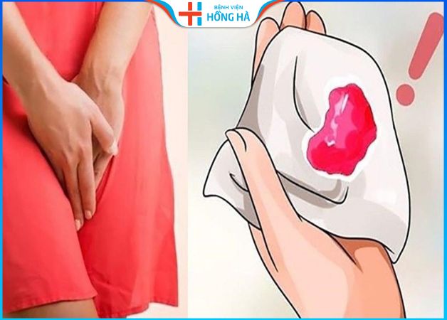 Máu báo thai có đau bụng không – Cách phân biệt máu kinh nguyệt