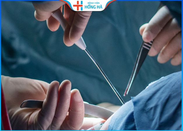 Chi phí phẫu thuật cắt tuyến vú tại Hồng Hà là 5.000.000 đồng