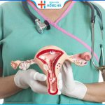 Siêu âm phát hiện được tới 95% trường hợp buồng trứng đa nang ở phụ nữ