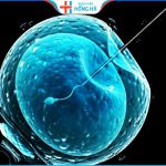 Đa nang buồng trứng: 90% trường hợp có thể điều trị thành công