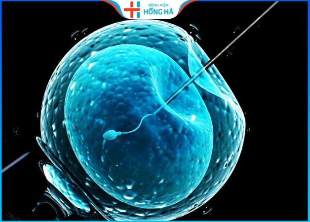 Đa nang buồng trứng: 90% trường hợp có thể điều trị thành công