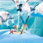 U xơ tử cung: Có cần phẫu thuật để điều trị – 2 phương pháp loại khối u xơ