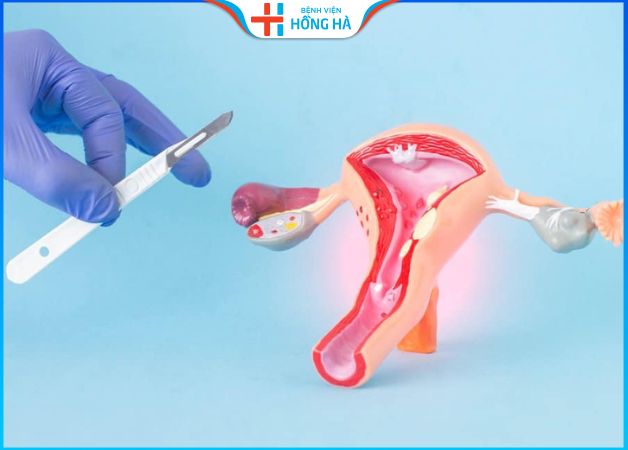 Thời gian phục hồi và ảnh hưởng sau khi phẫu thuật cắt bỏ tử cung