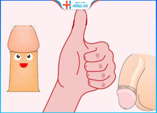 90% nam giới gặp vấn đề về bao quy đầu: Nguyên nhân và giải pháp