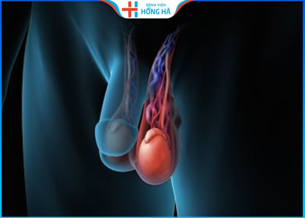 Giãn tĩnh mạch thừng tinh: Khả năng chữa khỏi và kỹ thuật điều trị