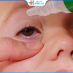 8 Loại thuốc nhỏ mắt trị đau mắt đỏ điều trị nhanh, hiệu quả
