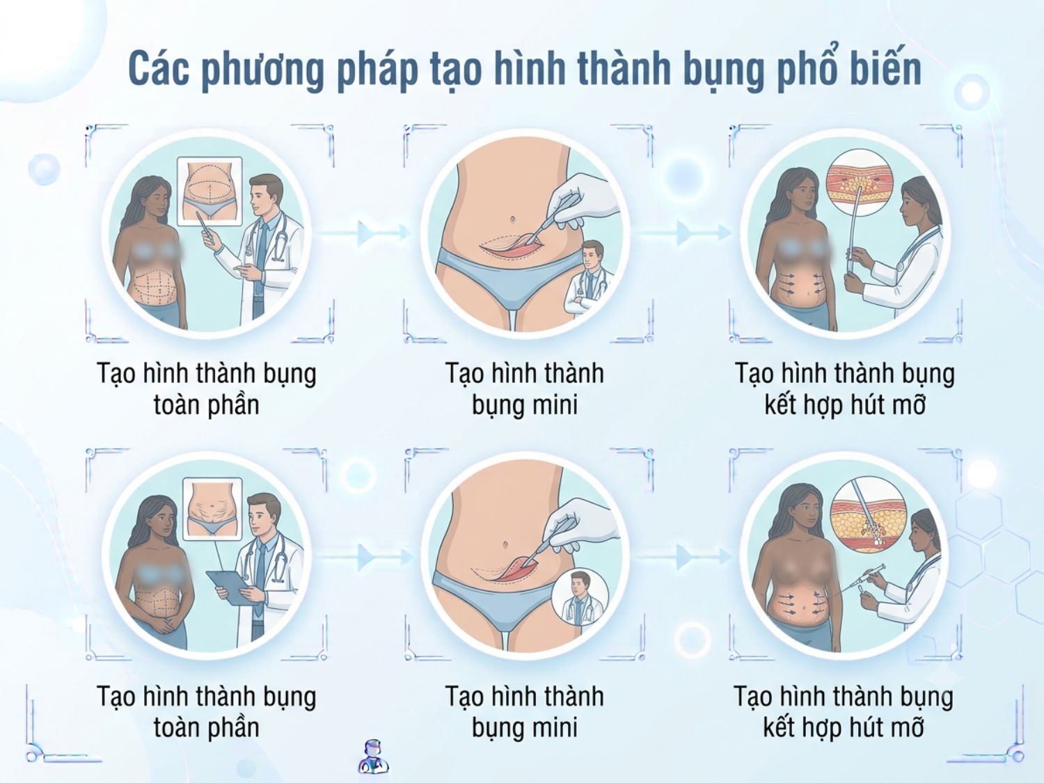 Tổng hợp các kỹ thuật tạo hình thành bụng phổ biến giúp khách hàng dễ dàng lựa chọn phương án phù hợp.