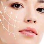 Phẫu thuật căng da mặt là gì? ưu điểm, quy trình và chi phí