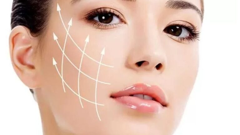 Phẫu thuật căng da mặt là gì? Ưu điểm, quy trình và chi phí