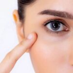 Cắt mí Thai Eyelid – Sở hữu mắt 2 mí to tròn thu hút ánh nhìn