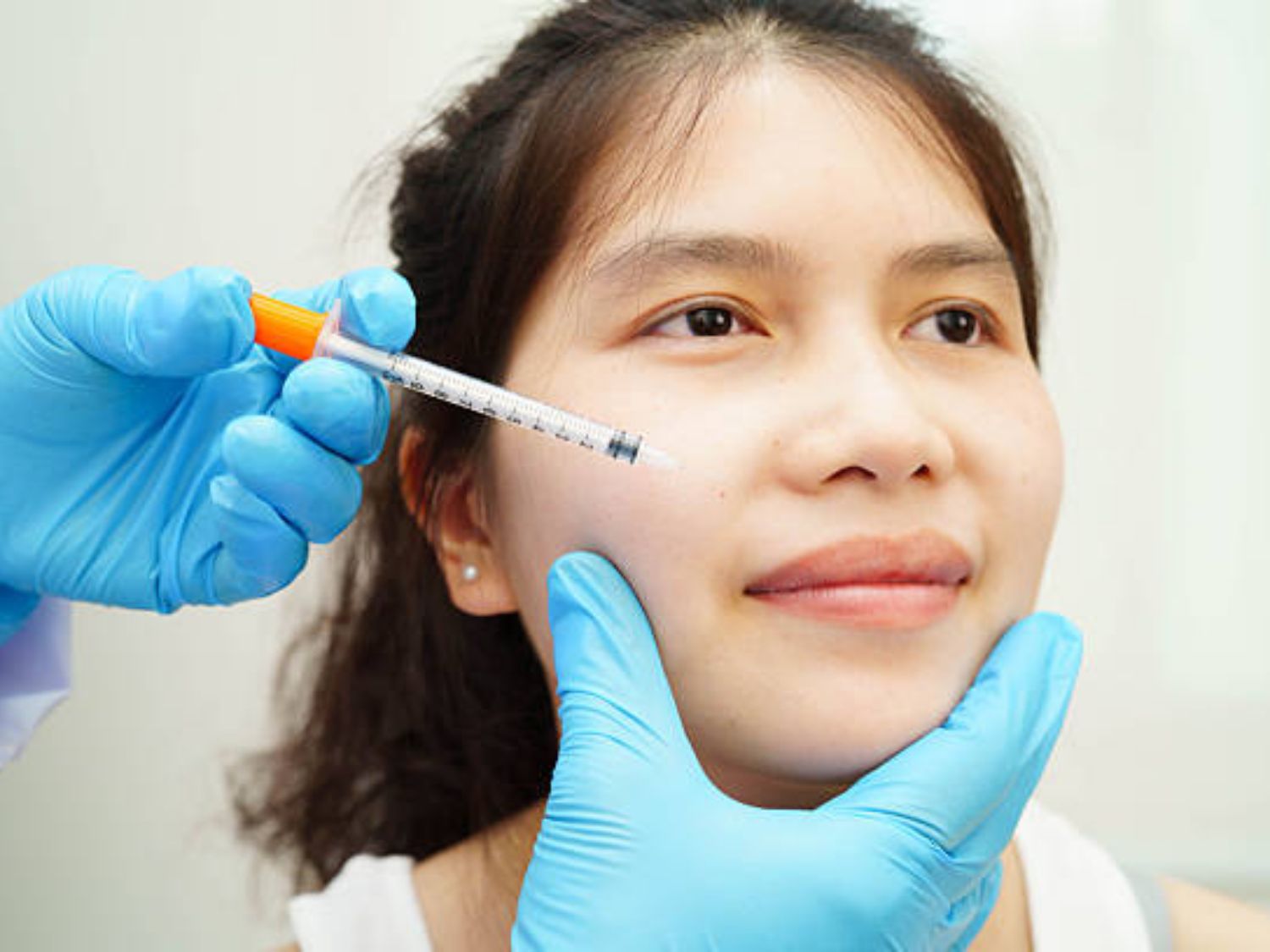 Tiêm Filler là kỹ thuật đưa chất làm đầy vào dưới mô da