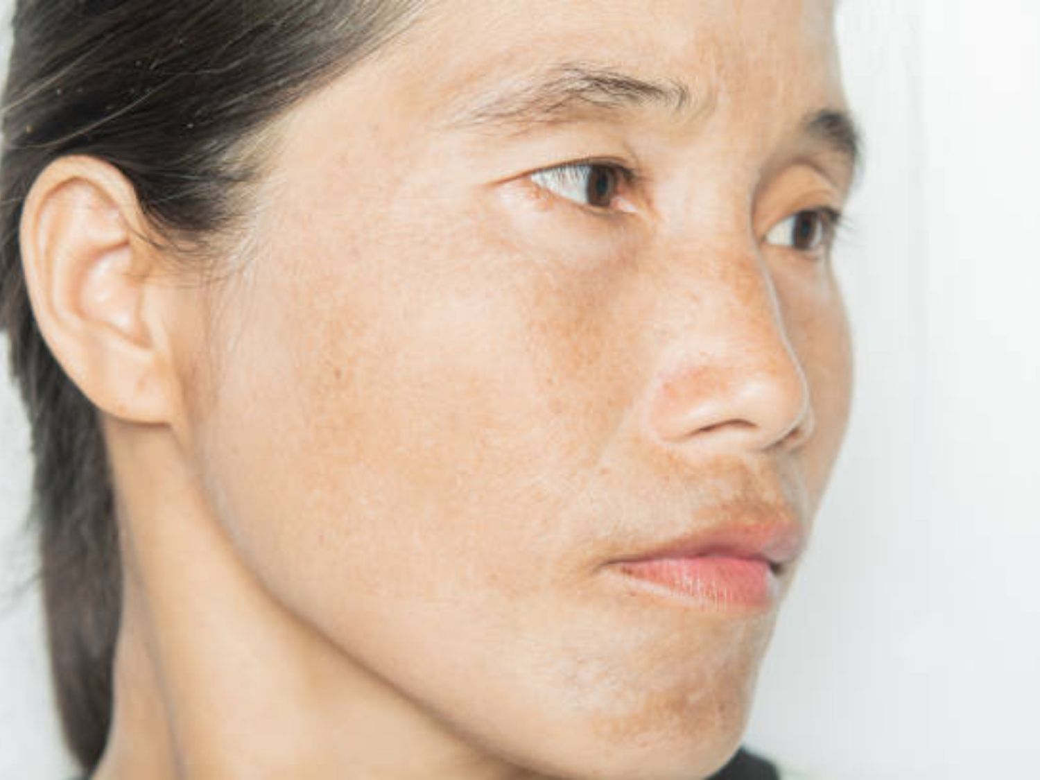 Da khô ráp, thiếu sức sống