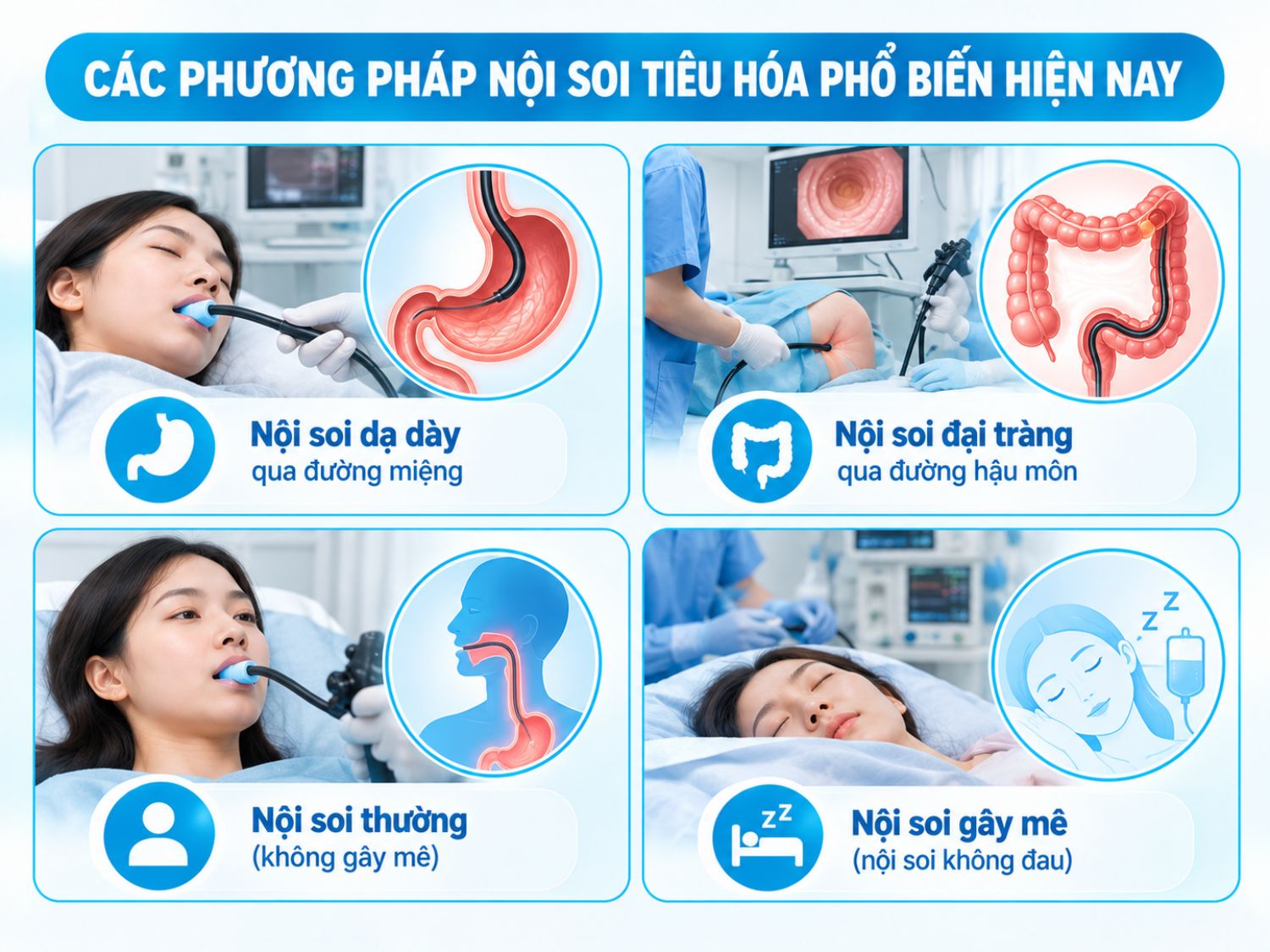Các phương pháp nội soi tiêu hóa phổ biến