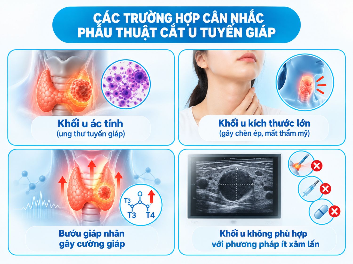 Các trường hợp cân nhắc phẫu thuật cắt u tuyến giáp