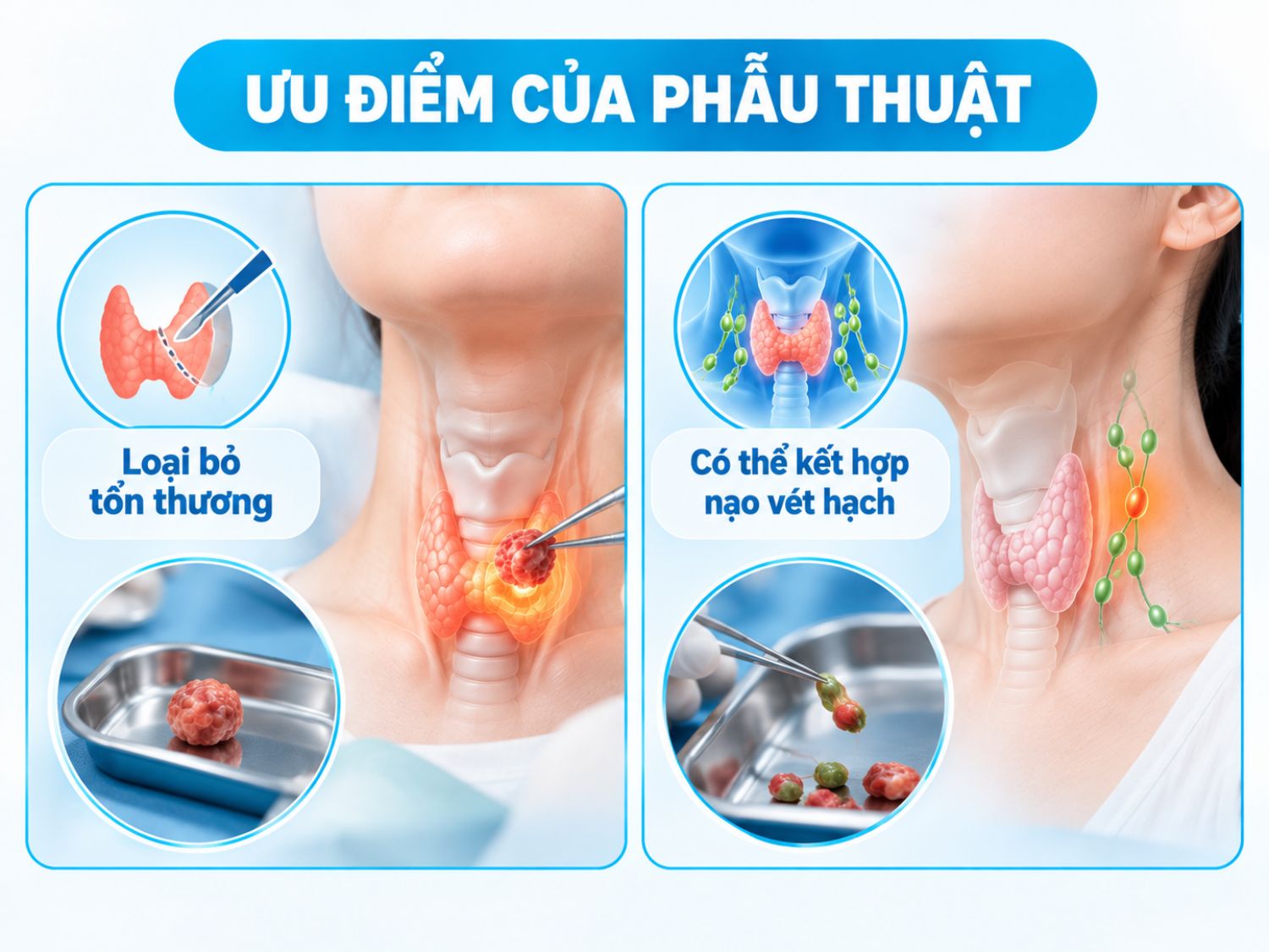 Ưu điểm của phẫu thuật